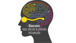 glaucoma