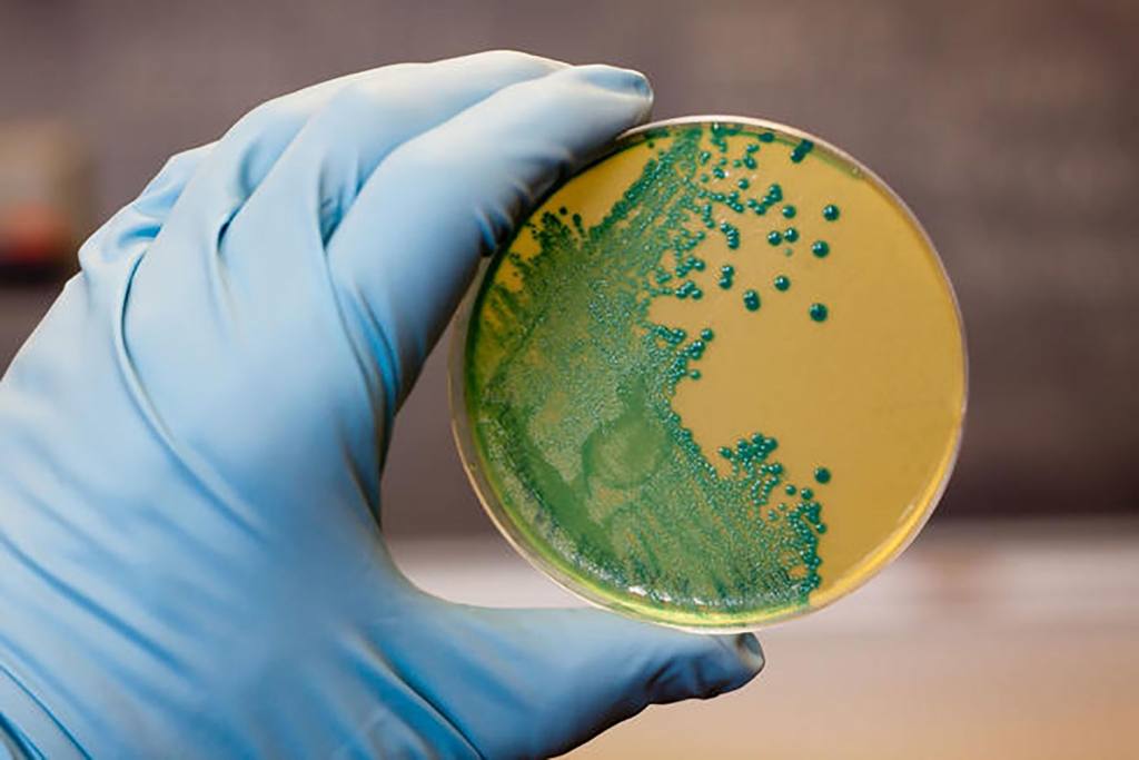 listeriosis 2 1