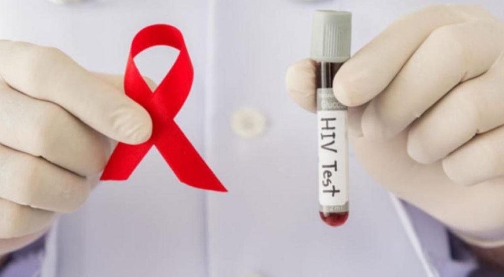 Este miércoles se celebra el Día mundial de la prueba del VIH vih