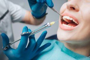 Anestesia dentista tipos