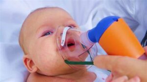 bronquiolitis