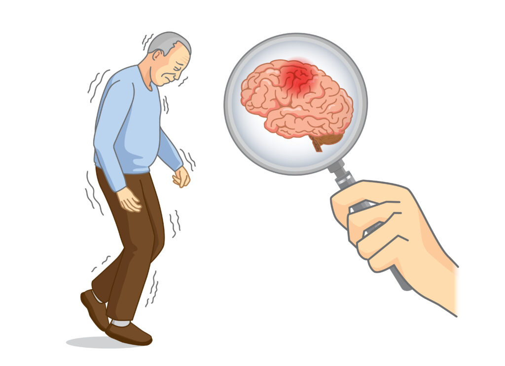 La Asociación Regional Parkinson Extremadura lanza campaña de sensibilización sobre salud mental en el Día Mundial de la Salud Mental parkinson