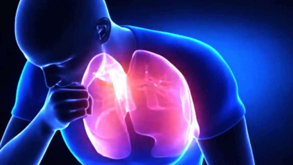 Tres casos de tuberculosis detectados en colegio de Badajoz tuberculosis