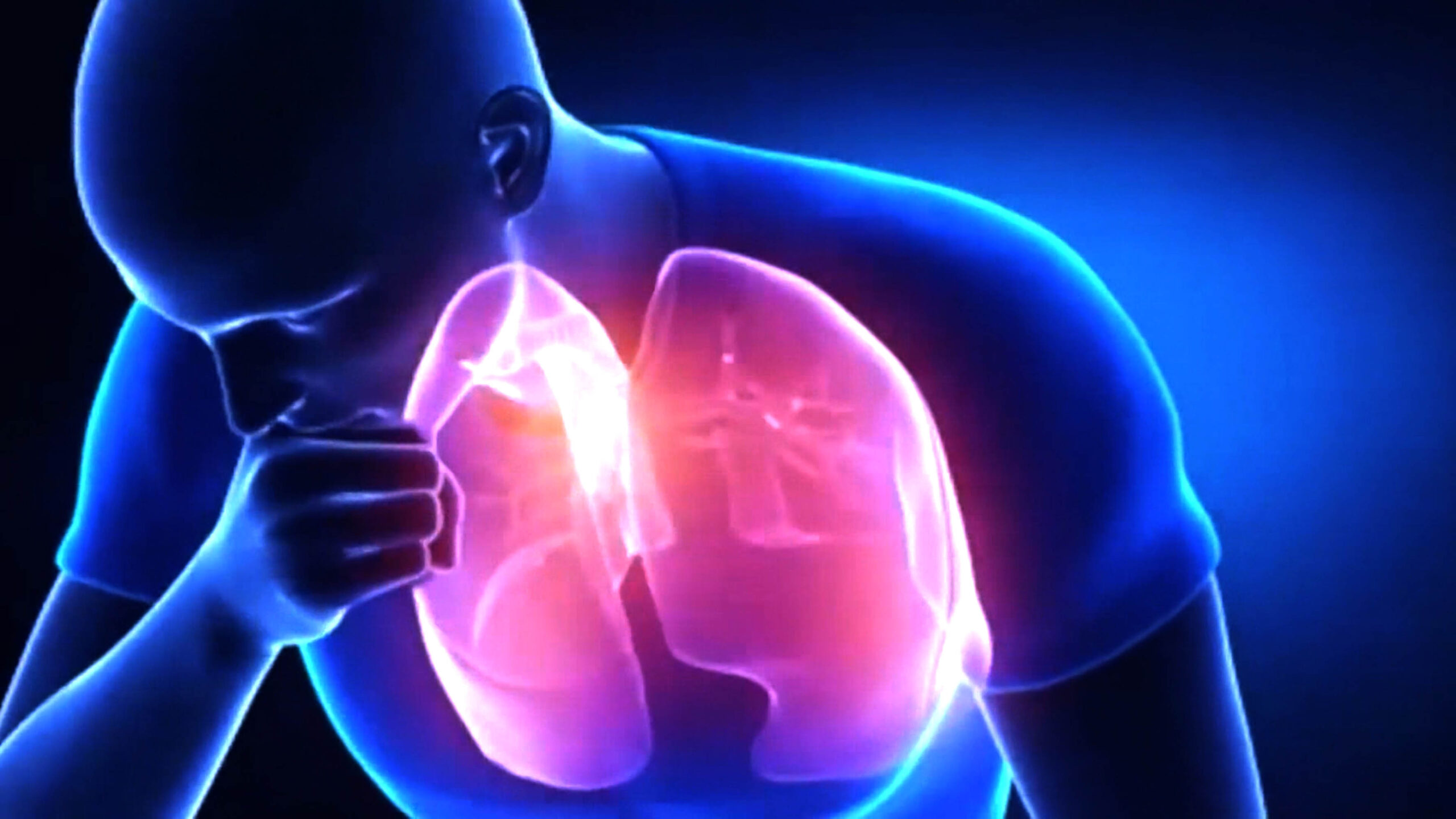 tuberculosis scaled