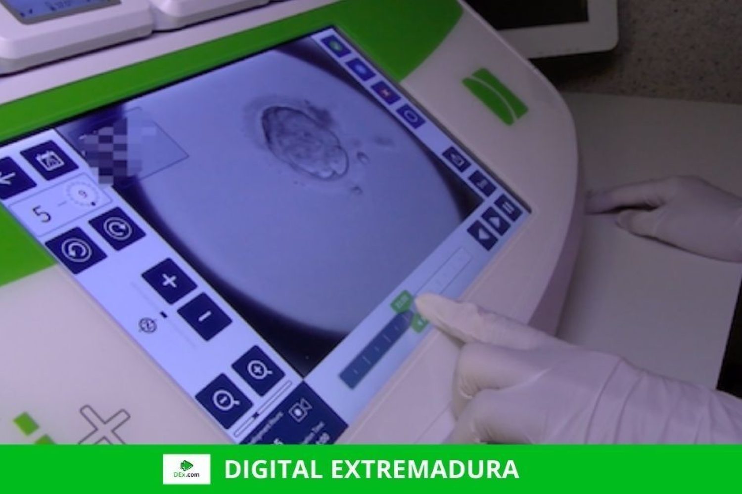 Veinte años del primer nacimiento de un niño extremeño por fecundación ‘in vitro’