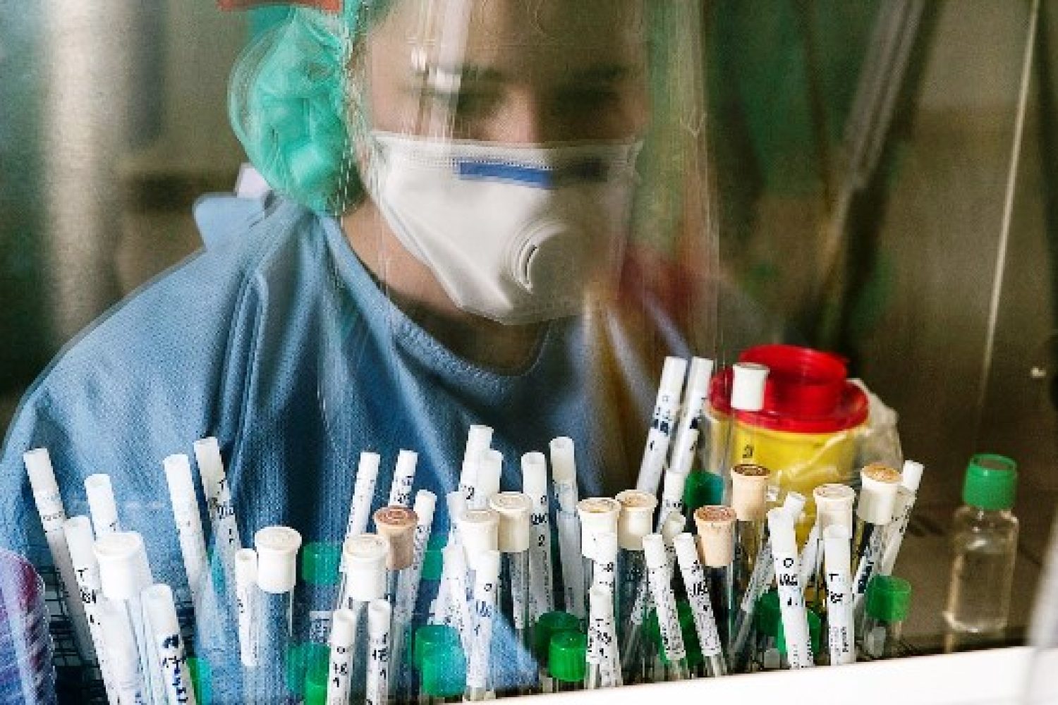 anticuerpos coronavirus