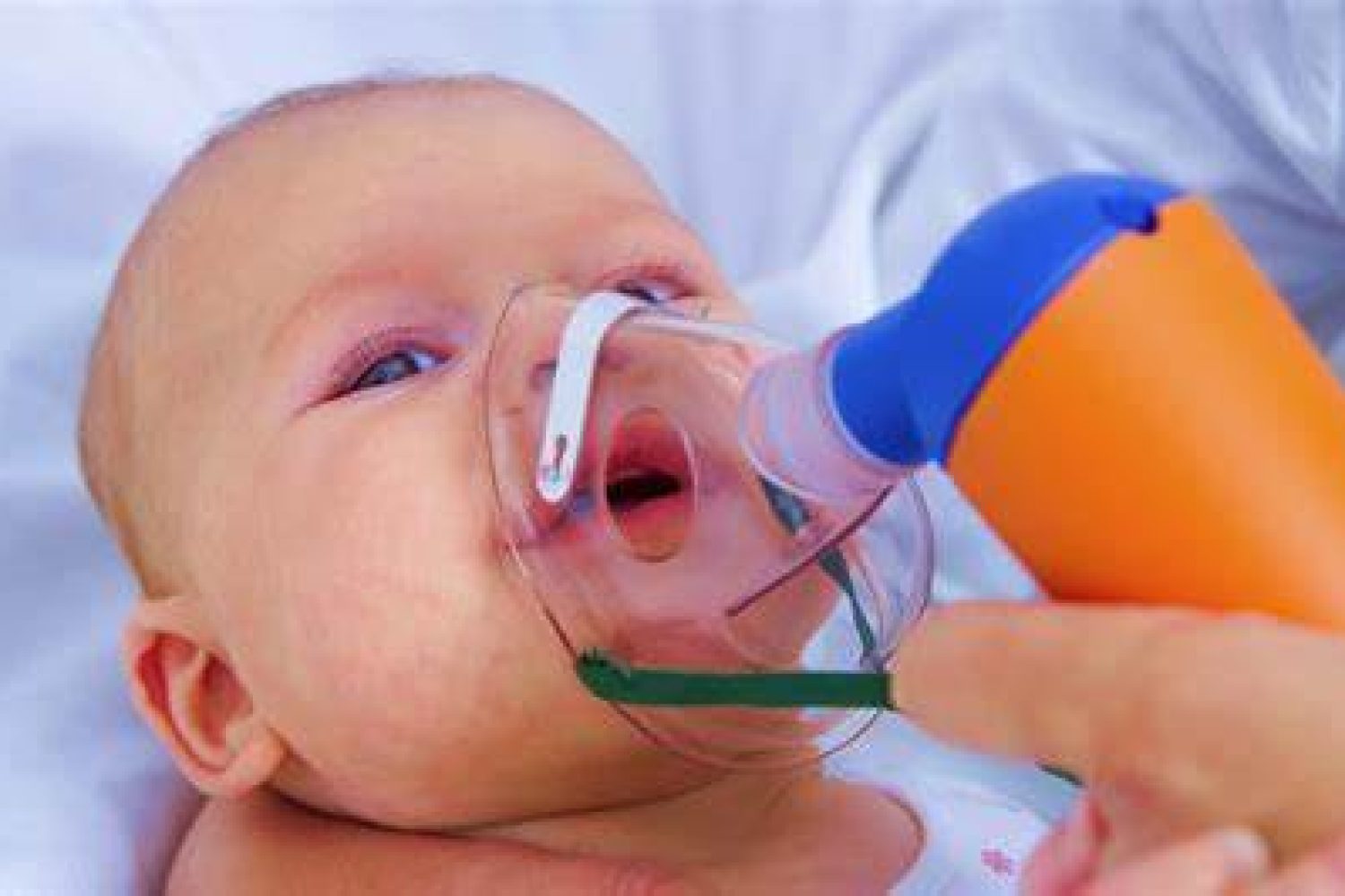 bronquiolitis