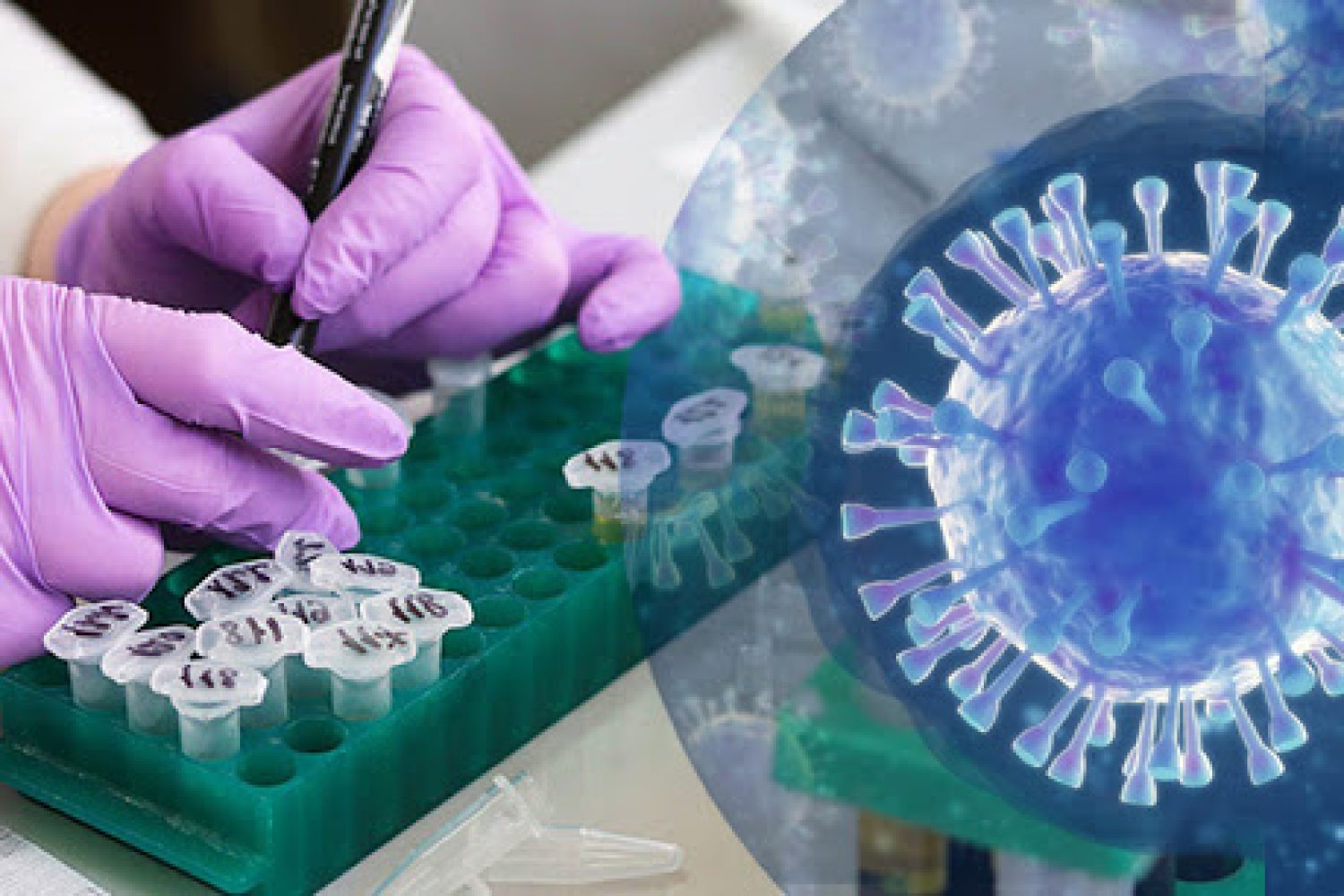 coronavirus