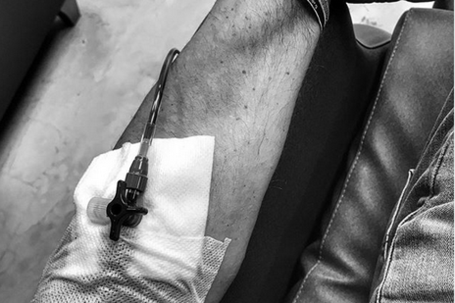 Imagen del brazo de dani Rovira, publicada por él mismo en su Instagram.