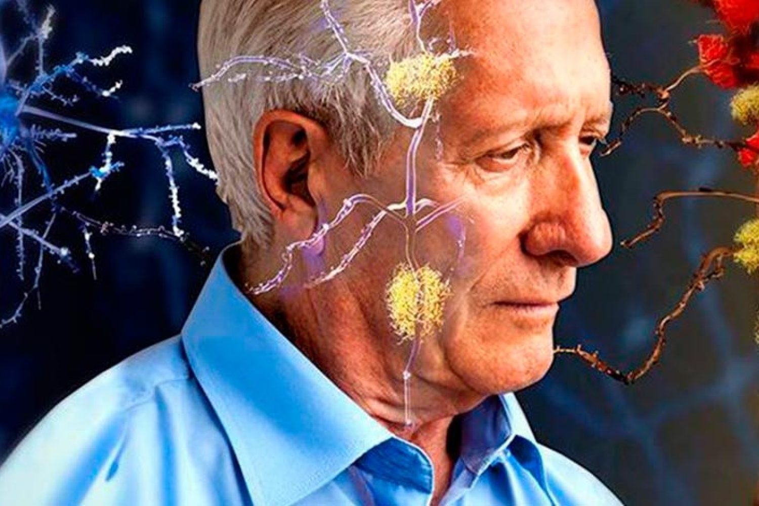 fases-del-alzheimer-00-Maidinbarcelona