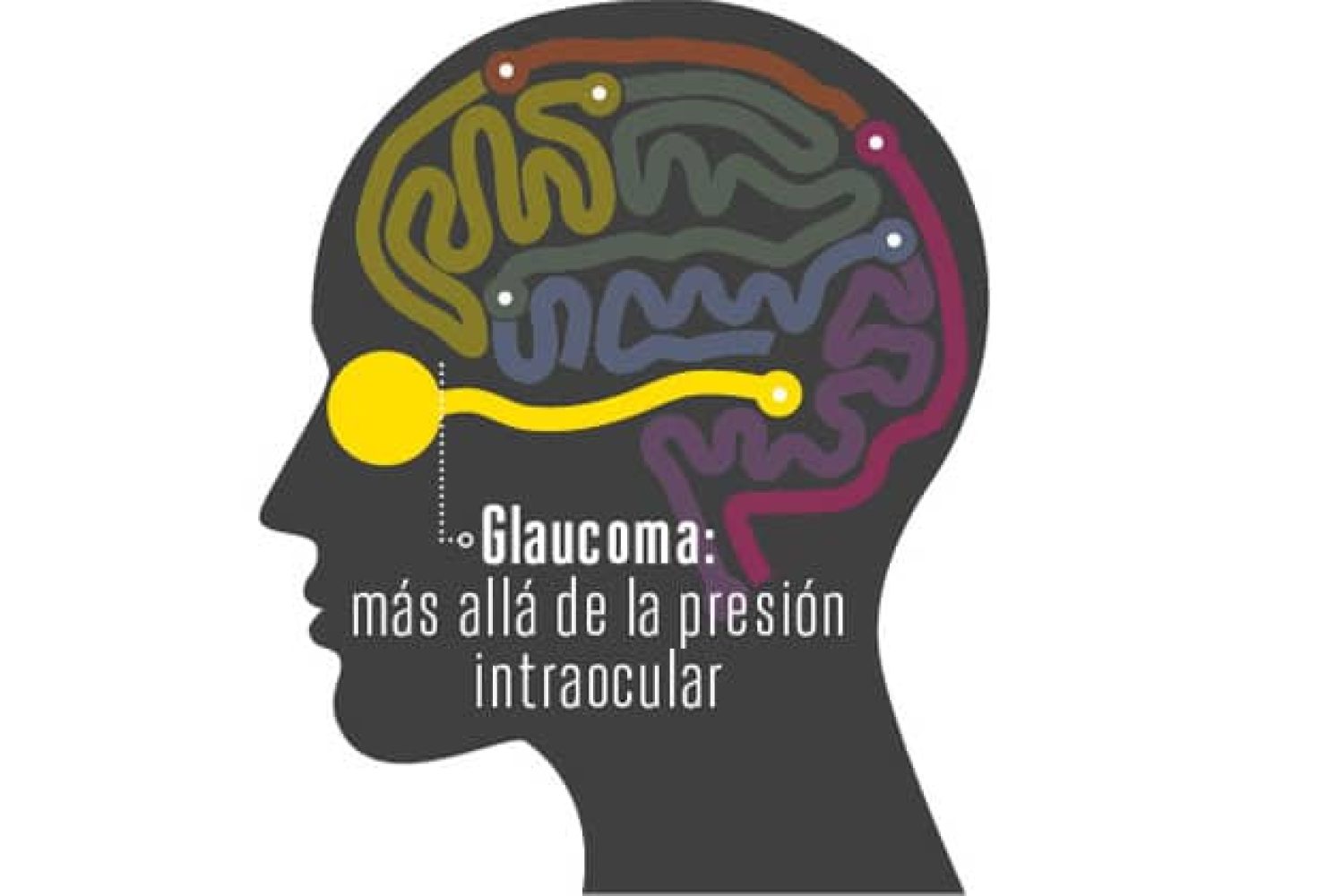 glaucoma