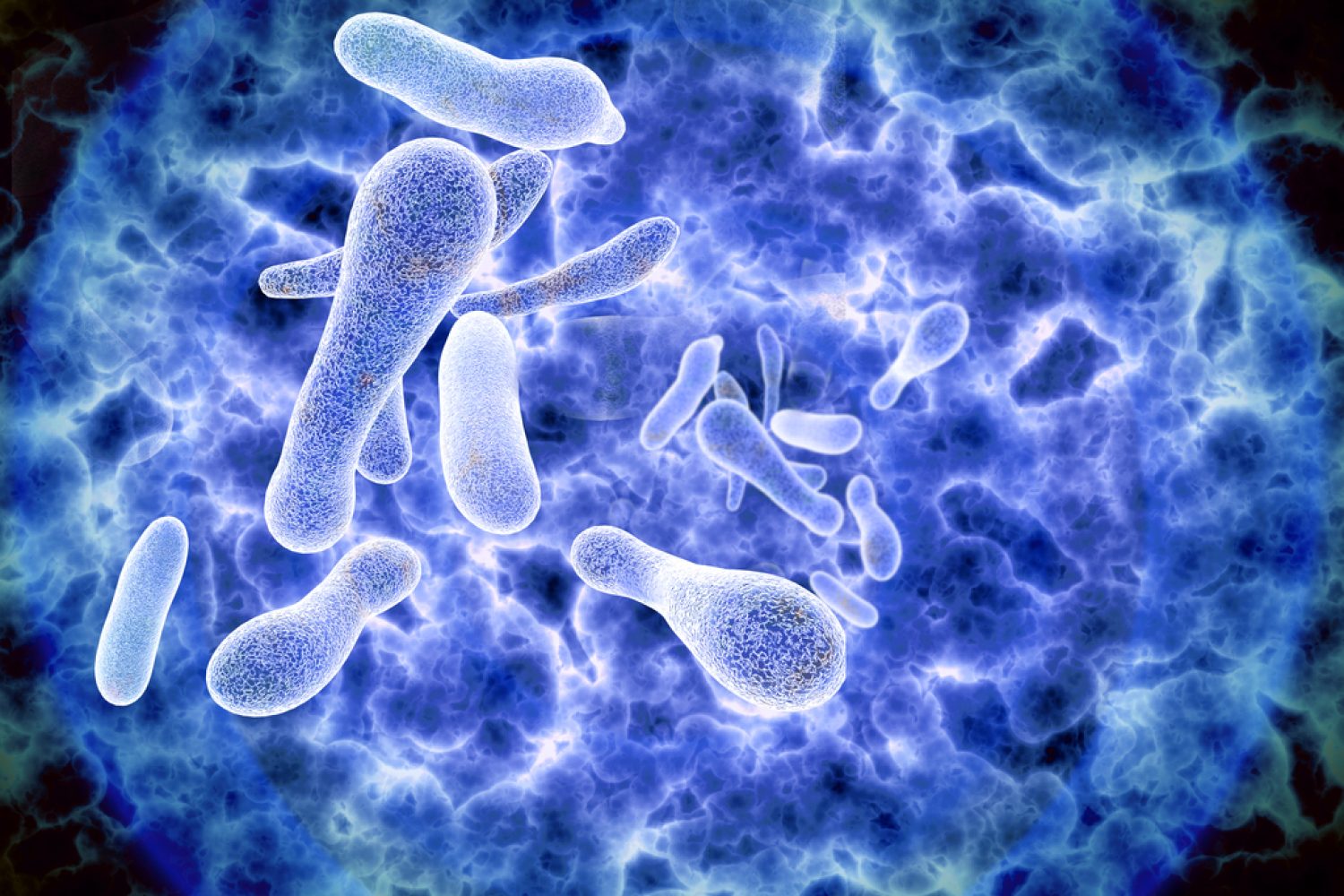 legionella