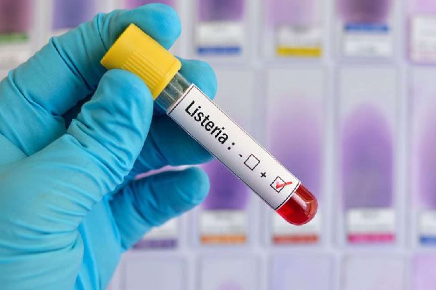 listeriosis