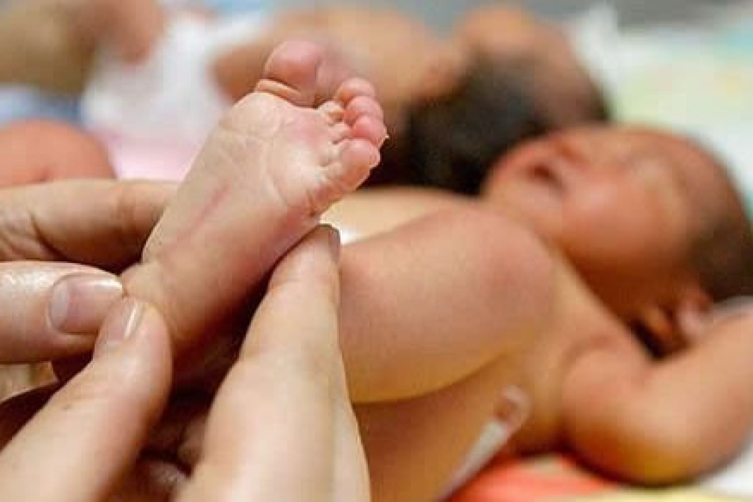 neonatal