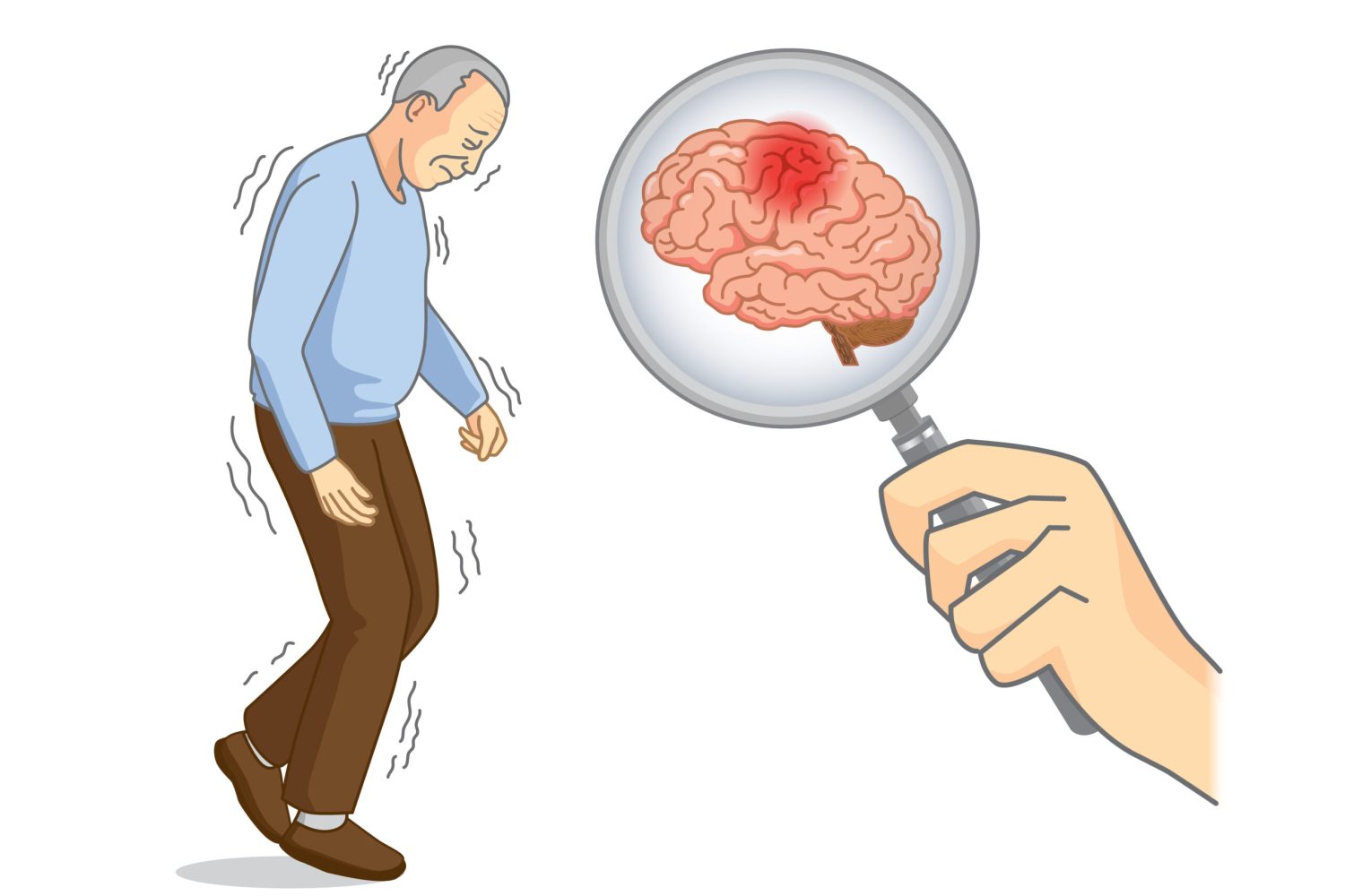 parkinson